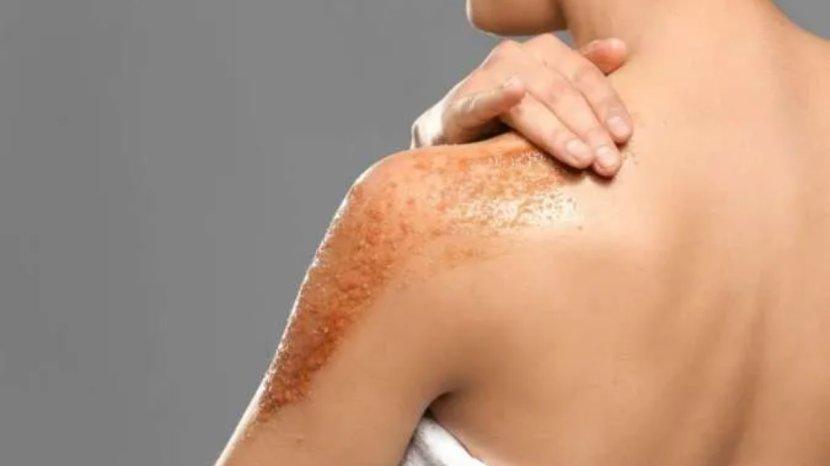 5-Rekomendasi-Body-Scrub-yang-Mencerahkan-dan-Menghaluskan-Kulit-Badan.jpg
