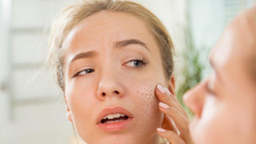 5 Tips Atasi Kulit Mengelupas dan Kering Saat Puasa Walau Sudah Pakai Skincare
