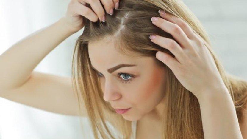 5-Tips-dan-Trik-Atasi-Jerawat-yang-Sering-Muncul-di-Sekitar-Garis-Rambut.jpg
