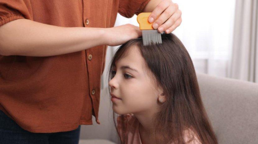 5 Cara Hilangkan Kutu Rambut Menggunakan Bahan yang Mudah Kamu Jumpai di Rumah