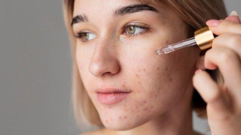 5 Rekomendasi Skincare yang Punya Kandungan Tea Tree, Ampuh Mengatasi Permasalahan Jerawat