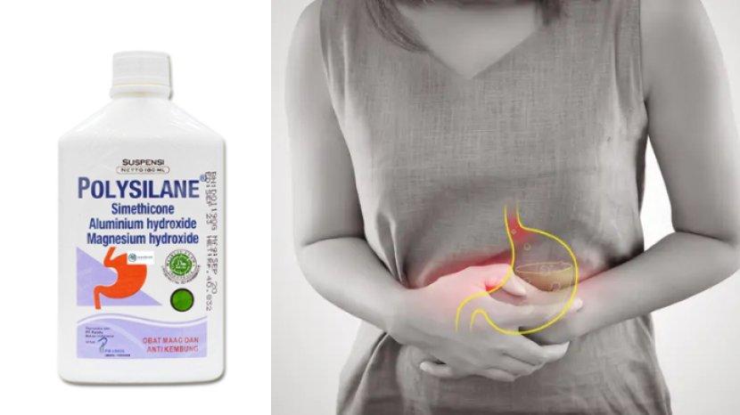 5-rekomndasi-obat-maag-asam-lambung-paling-manjur-salah-satunya-polysilane.jpg