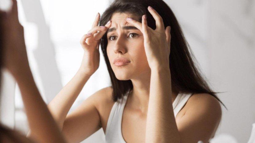 5 Cara Memutihkan Dahi yang Belang Akibat Keseringan Pakai Helm