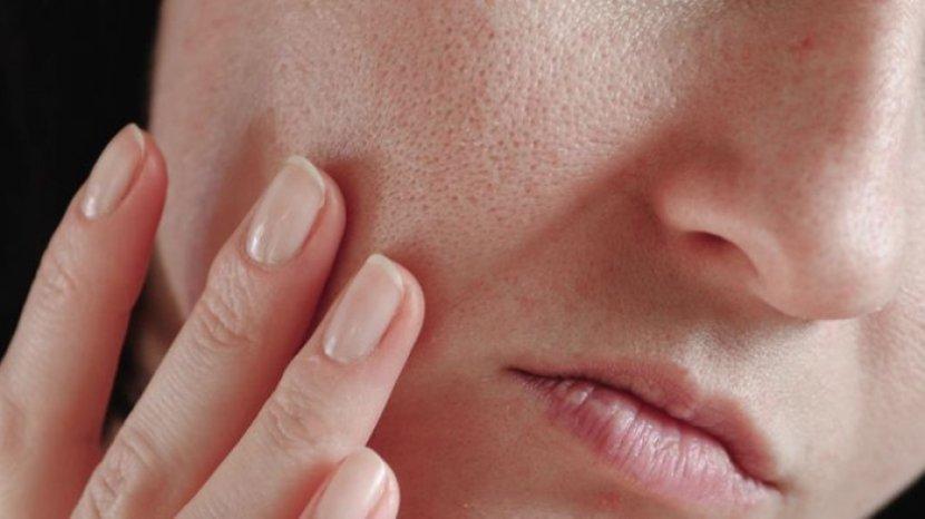 5 Cara Mengecilkan Pori-pori Menggunakan Bahan Alami, Bikin Wajah Jadi Mulus
