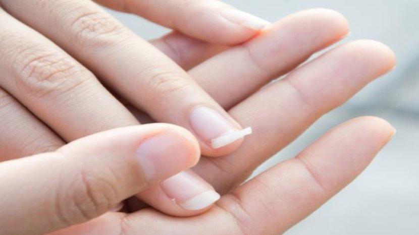5 Tips Merawat Kuku Agar Kuat dan Tidak Mudah Patah, Cukup Pakai Bahan Alami