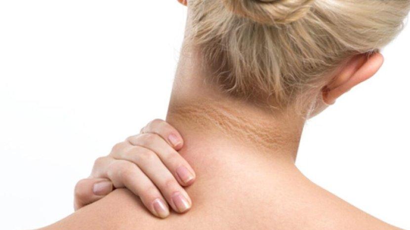 10 Cara Mengatasi Leher yang Menghitam, Bisa Gunakan Bahan Rumahan yang Mudah Ditemukan