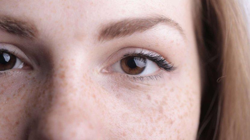 6 Kesalahan Pakai Skincare yang Membuat Flek Hitam di Wajah Makin Parah