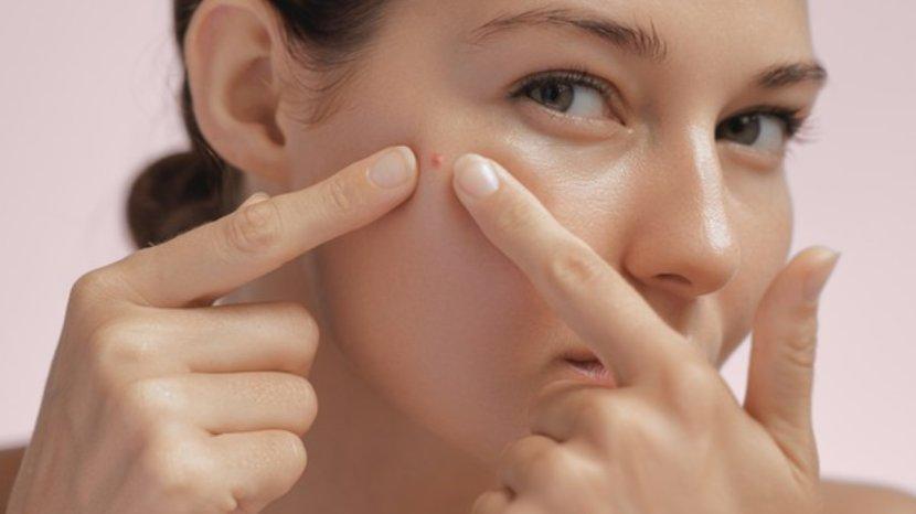 6-Tips-Mengurangi-Kemerahan-Karena-Jerawat-Salah-Satunya-Rajin-Pakai-Sunscreen-ew.jpg