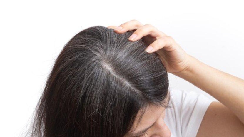 7 Cara Menghilangkan Uban Pakai Bahan Alami, Rambut Kembali Hitam Seperti Semula