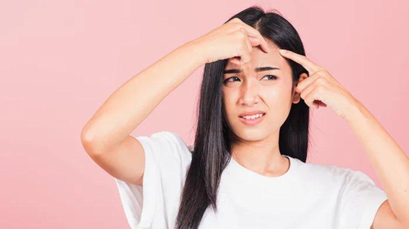 7-Rekomendasi-Acne-Spot-Treatment-Terjangkau-untuk-Hilangkan-Jerawat-d.jpg