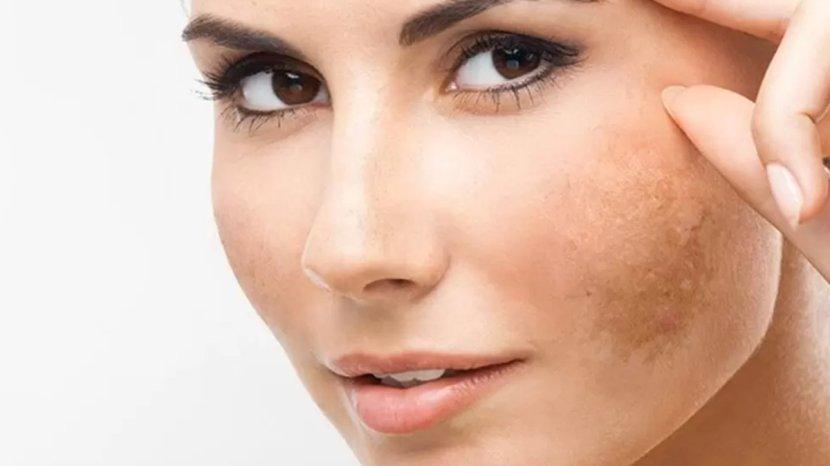 7-Rekomendasi-Face-Serum-yang-Ampuh-Meratakan-Warna-Kulit-Akibat-Flek-di-Wajah.jpg