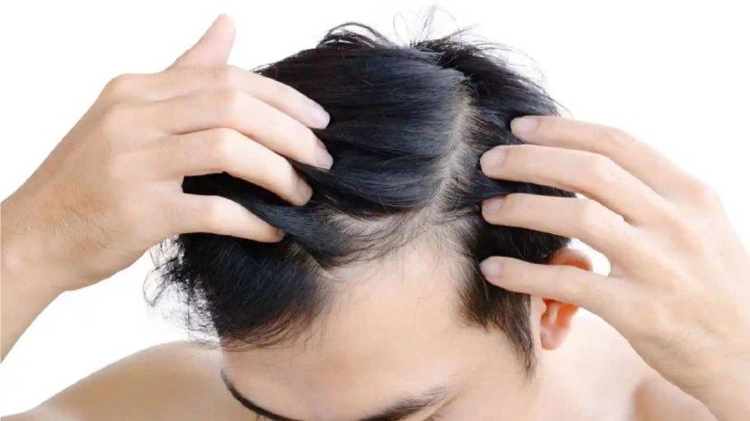 7-Tips-Manjur-Melebatkan-Rambut-Pakai-Bahan-bahan-Alami-Mudah-DIlakukan-Di-Rumah.jpg