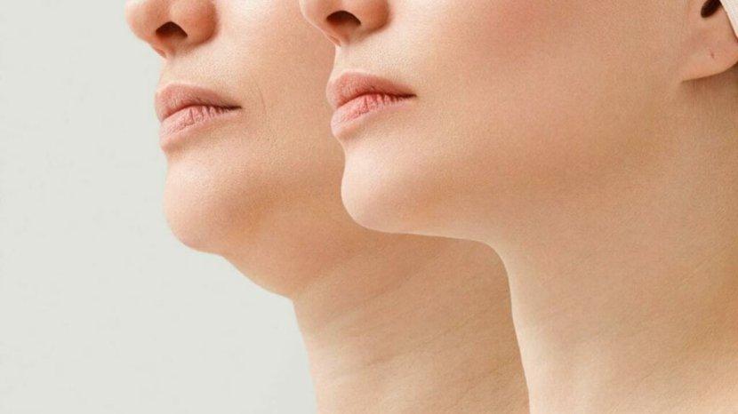 7-Tips-dan-Trik-Menghilangkan-Double-Chin-Tanpa-Operasi.jpg