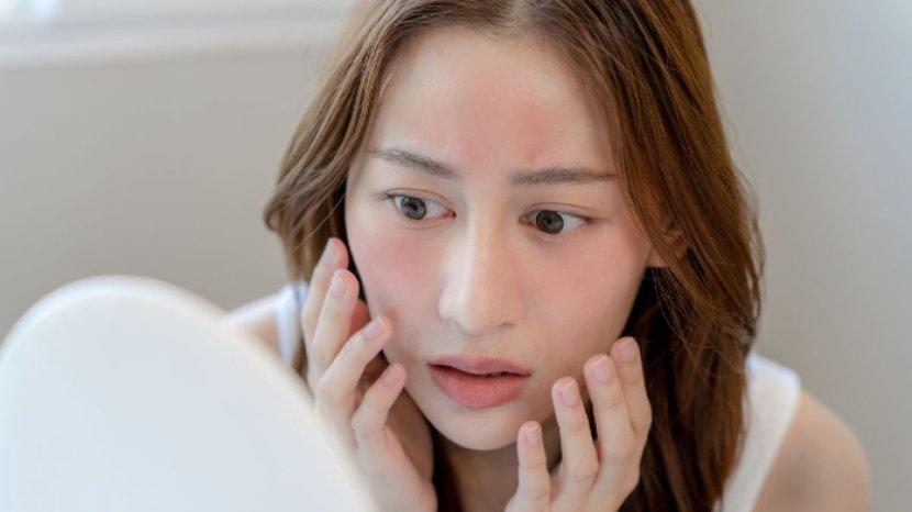 7 Cara Alami Mengobati Wajah Gatal karena Tidak Cocok Pakai Produk Skincare