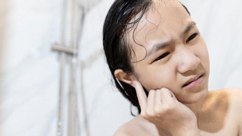 7 Cara Cepat Mengatasi Telinga Kemasukan Air, Tak Perlu Panik dan Buru-buru ke Dokter