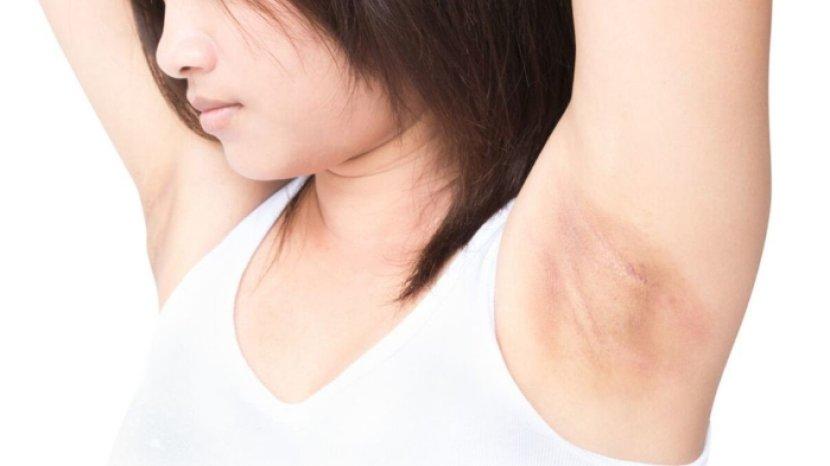 7 Tips Mencukur Bulu Ketiak yang Benar Agar Tidak Hitam