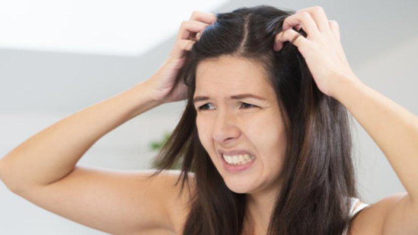 5 Bahan Alami untuk Menghilangkan Kulit Kepala Gatal, Stop Garuk-garuk