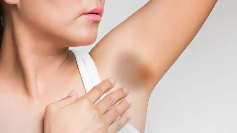 9 Tips Memutihkan Ketiak Gelap Tanpa Bantuan Laser, Cukup Pakai Bahan Alami