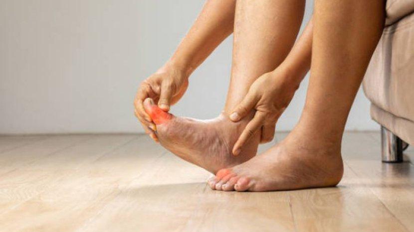 9 Obat Alami ini Bisa Bantu Meredakan Asam Urat di Tubuh