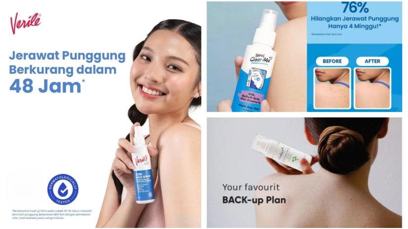 Daftar-Produk-Back-Acne-Spray-Terbaik.jpg