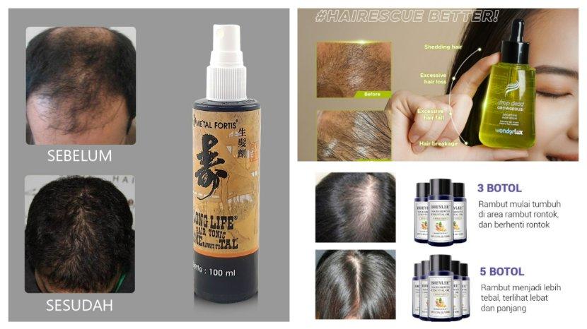 30 Daftar Produk Penyubur Rambut Terbaik yang Aman dan Sudah BPOM, Ampuh Cegah Rontok dan Kebotakan