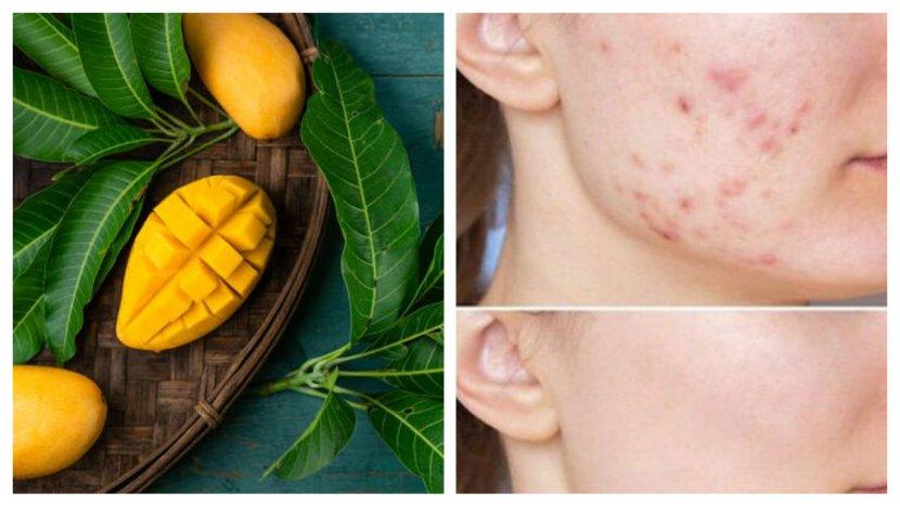 8 Daun yang Bisa jadi Masker Alami Hempas Jerawat di Wajah, Bisa Dicoba di Rumah