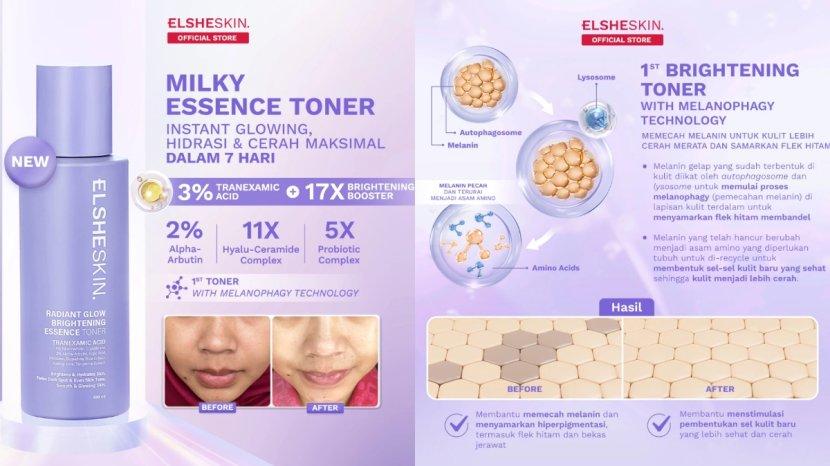 Elsheskin-Radiant-Glow-Brightening-Essence-Tonerdgnjd.jpg
