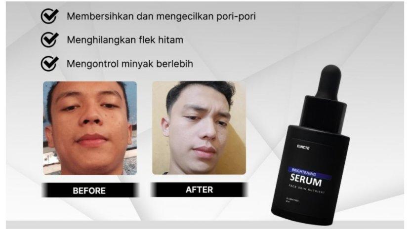 Elvicto-Brightening-Serum566.jpg