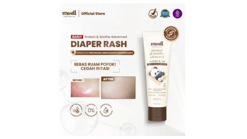 Review Lengkap Moell Diaper Rash Advanced: Manfaat, Kelebihan, hingga Kekurangan