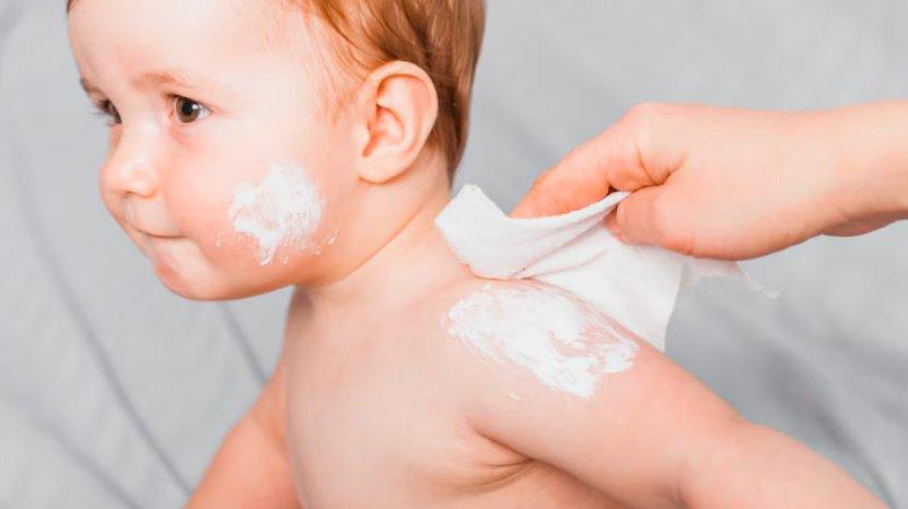 Tips Menghilangkan Bercak Putih pada Kulit Bayi dan Penyebab yang Harus Dihindari