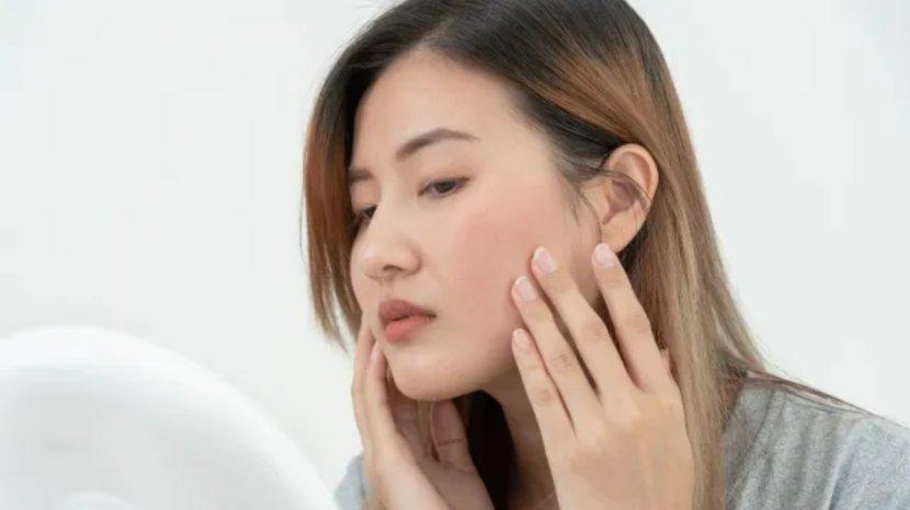 Ketahui-Perbedaan-Kulit-Sensitif-dan-Alergi-Hampir-Mirip-Tapi-Berbeda-sde.jpg