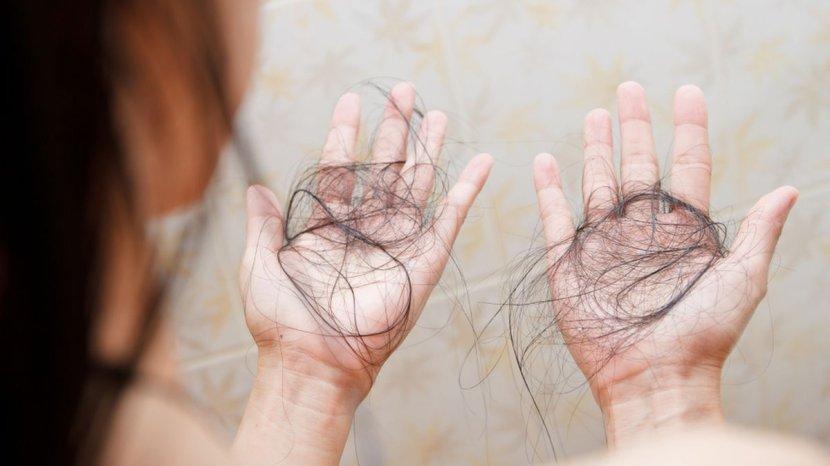 Minyak Zaitun hingga Daun Buah Bit, Ini 7 Bahan Alami yang Bisa Mengatasi Rambut Rontok