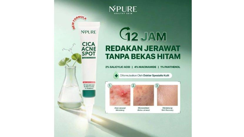 Review NPURE Cica Acne Spot Cream: Manfaat, Kelebihan hingga Kekurangan