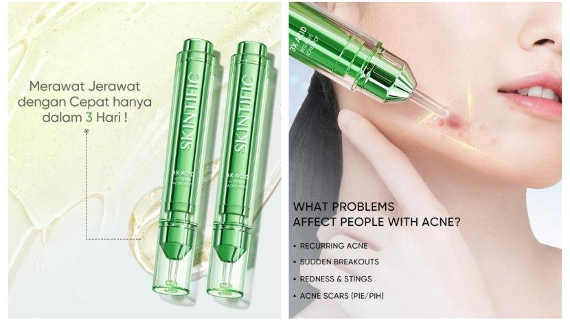 SKINTIFlC-3X-Acid-Intensive-Acne-Spot-Gel-4.jpg