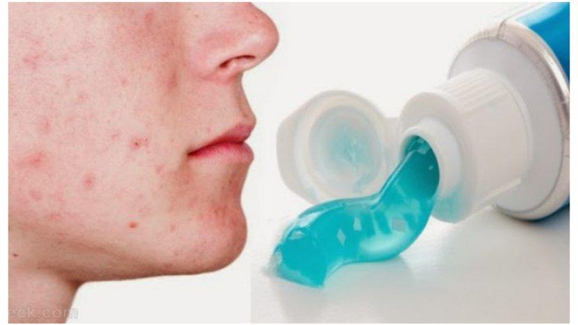 9 Tips dan Trik Kecantikan Ini Sering Dipercaya, Padahal Belum Tentu Manjur