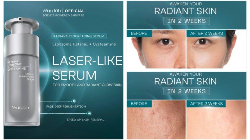 Review Wardah Radiant Resurfacing Retinal Cysteamine Serum, Produk Terbaru yang Ampuh Cegah Penuaan