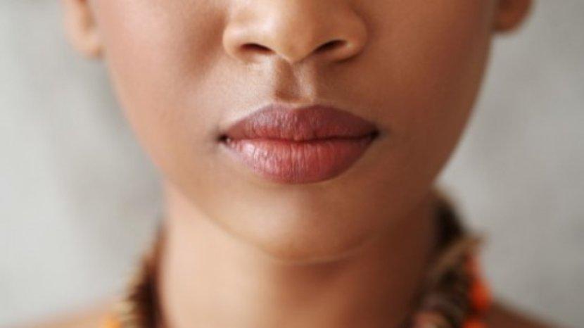 bibir-gelap-atau-menghitam-bisa-kamu-atasi-dengan-menggunakan-cara-cara-alami.jpg