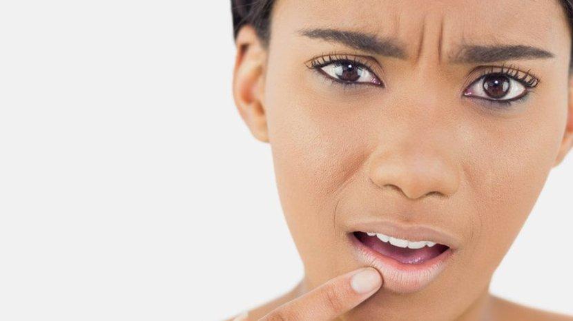5 Cara Alami Atasi Bibir Hitam agar Warna Kembali Cerah Berseri