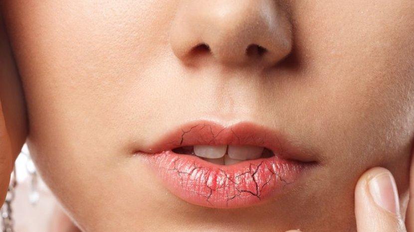 Bibir Kering Akibat Lipstik? Lembapkan dengan 6 Bahan Alami Ini