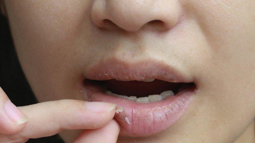 7 Bahan Alami Terbaik yang Murah dan Ampuh untuk Mengatasi Bibir Kering serta Pecah-pecah