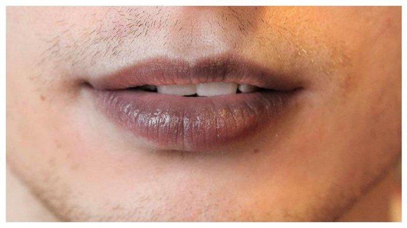 bibir-menghitam.jpg