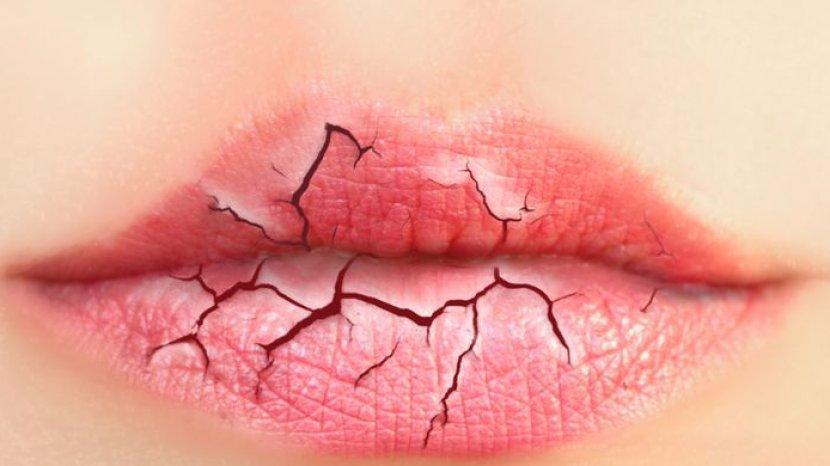 5 Tanda Kamu Alergi Terhadap Lipstik yang Mengandung Bahan Kimia Berbahaya