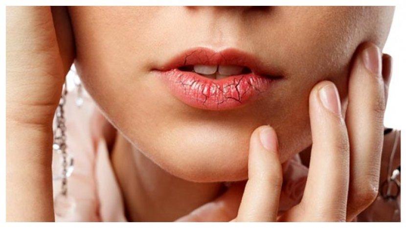 Lakukan Secara Mandiri Perawatan di Rumah Agar Bibir Terlihat Sehat