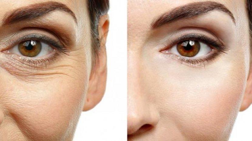 5 Rekomendasi Eye Cream Terbaik, Mampu Atasi Mata Panda hingga Tanda-tanda Penuaan