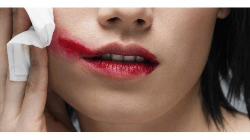 6 Faktor yang Membuat Bibir Menjadi Hitam, Salah Satunya karena Penggunaan Produk Lipstik Abal-abal