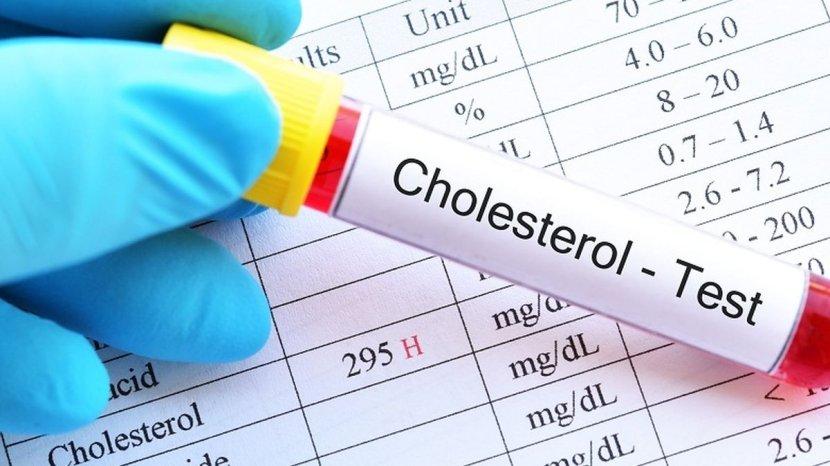 Apa yang Harus Segera Dilakukan saat Kolesterol Naik? Temukan Jawabannya di Sini