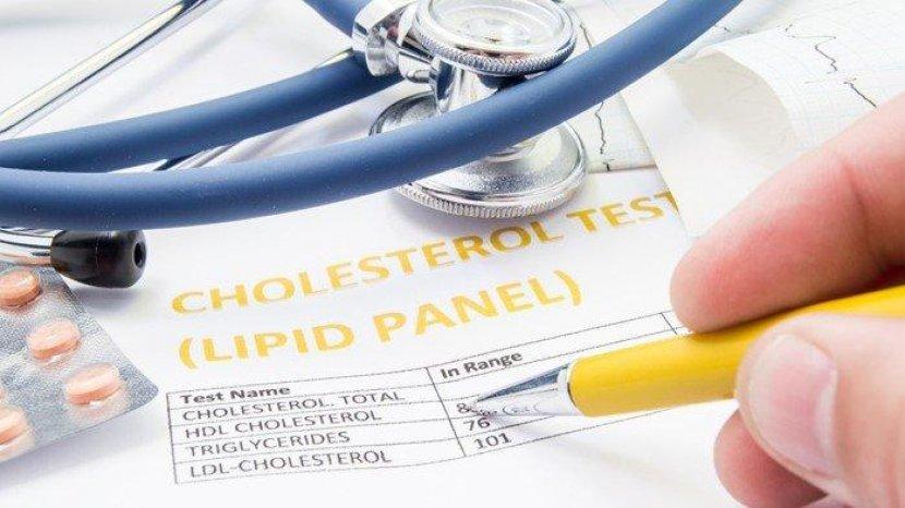 Mengenal Kolesterol dan Faktor Penyebab Tingginya Kadar Kolesterol dalam Tubuh