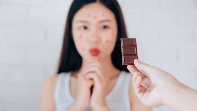 cokelat-jadi-makanan-yang-bisa-memperparah-jerawat.jpg