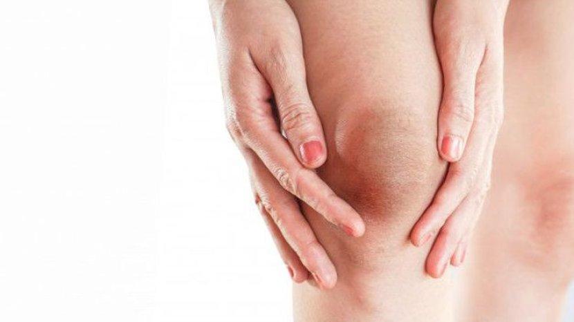 7 Bahan Alami Cerahkan Lutut yang Hitam, Murah Meriah Anti Ribet