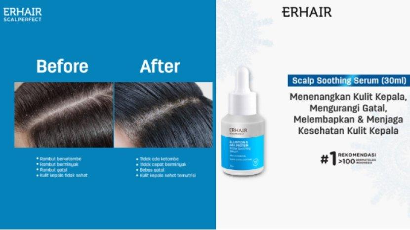 Review ERHAIR Scalperfect Allantoin and Silk Protein, Lembapkan Rambut dan Kulit Kepala